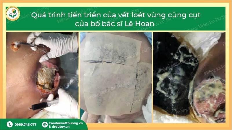 lo-loet-vung-cung-cut-nguoi-cao-tuoi (1)